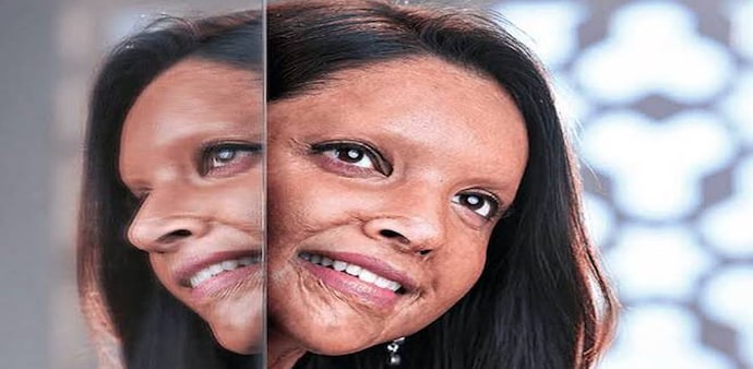 Chhapaak Box Office Collection: Chhapaak made Rs 4.77 crore on its opening day, followed by Rs 6.90 crore on Saturday, Rs 7.35 crore on Sunday, Rs 2.35 crore on Monday and Rs 2.20 crore on Tuesday Chhapaak Box Office Collection: Chhapaak made Rs 4.77 crore on its opening day, followed by Rs 6.90 crore on Saturday, Rs 7.35 crore on Sunday, Rs 2.35 crore on Monday and Rs 2.20 crore on Tuesday