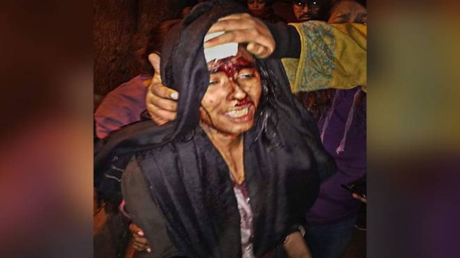 JNUSU president Aishe Ghosh was seriously injured in an attack by masked miscreants JNUSU president Aishe Ghosh was seriously injured in an attack by masked miscreants