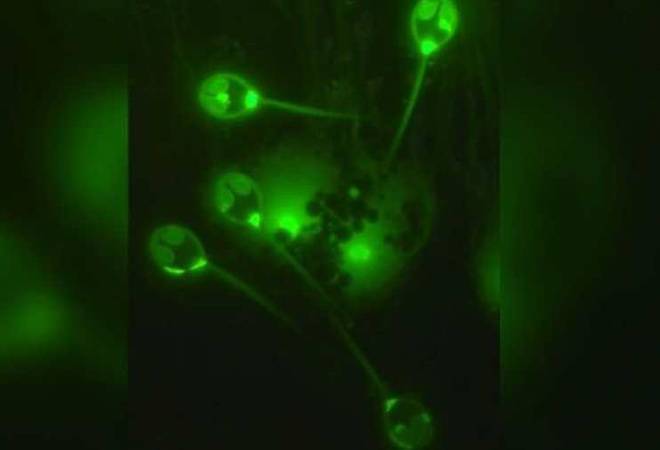 Representative image Representative image