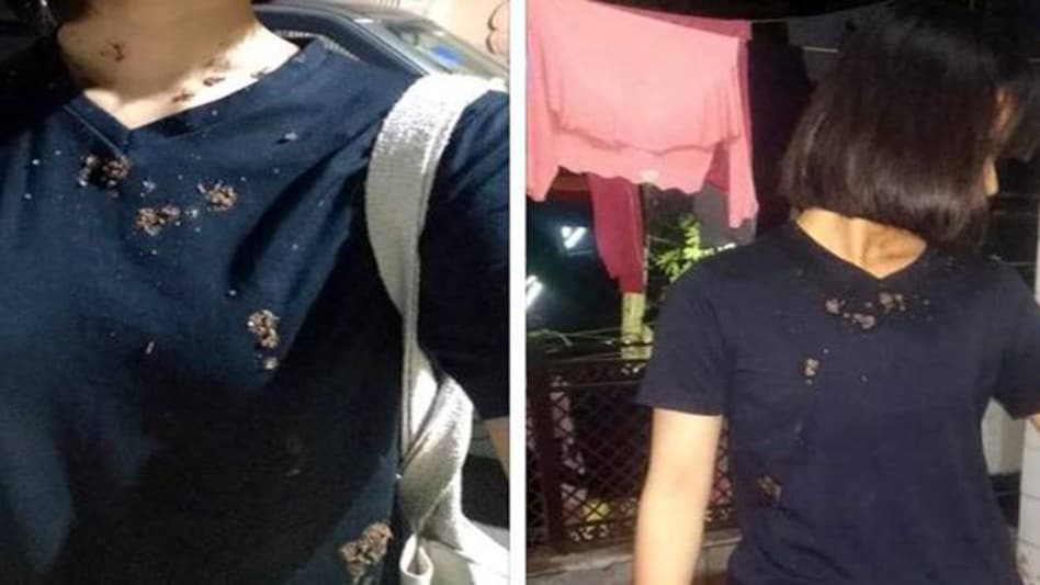 A man spat on a Manipuri girl and called her 'corona' in Delhi. A man spat on a Manipuri girl and called her 'corona' in Delhi.