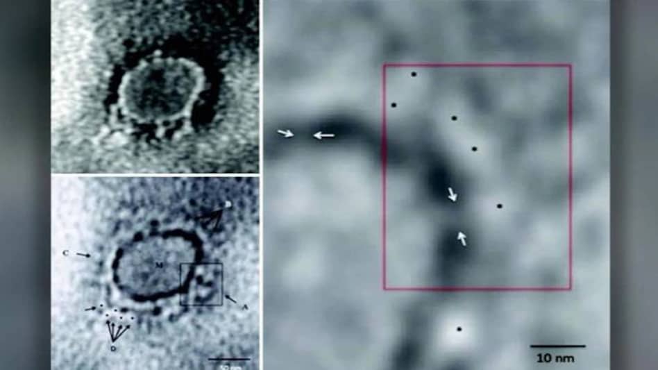Microscopic image of Novel Coronavirus Microscopic image of Novel Coronavirus