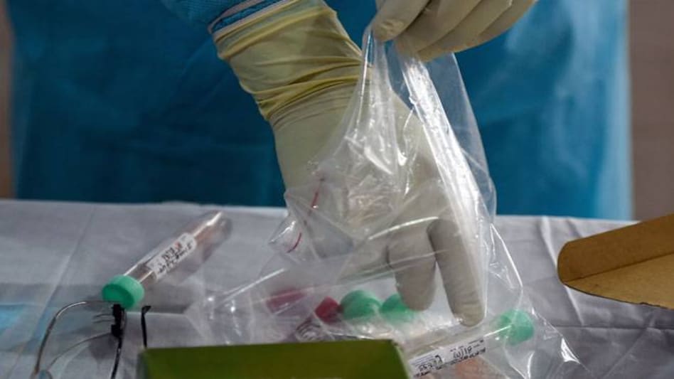 Pooling of samples involves testing them in batches and when pooled sample tests positive, then individual samples are assessed Pooling of samples involves testing them in batches and when pooled sample tests positive, then individual samples are assessed