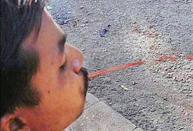 Spitting in public is an offence under municipal laws in various municipalities in the country, but it was never followed seriously Spitting in public is an offence under municipal laws in various municipalities in the country, but it was never followed seriously