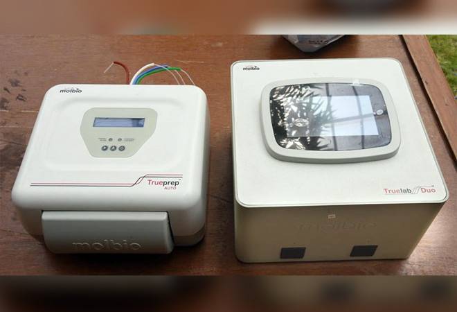 The AMTZ Trueprep coronavirus testing kit The AMTZ Trueprep coronavirus testing kit