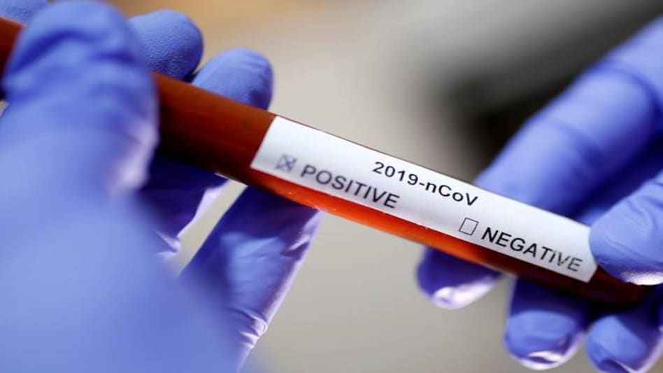 Israel has reported 16,246 cases and 235 deaths from coronavirus Israel has reported 16,246 cases and 235 deaths from coronavirus