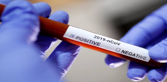 Coronavirus testing in India Coronavirus testing in India