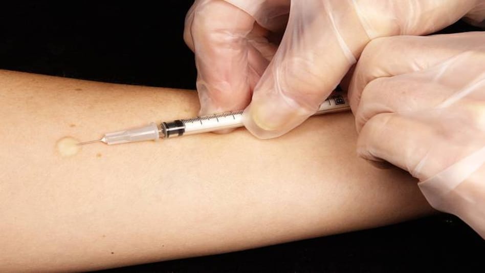 According to the study, developing countries, where TB vaccine was given on higher rates, have lower-than-expected COVID-19 death rates. According to the study, developing countries, where TB vaccine was given on higher rates, have lower-than-expected COVID-19 death rates.