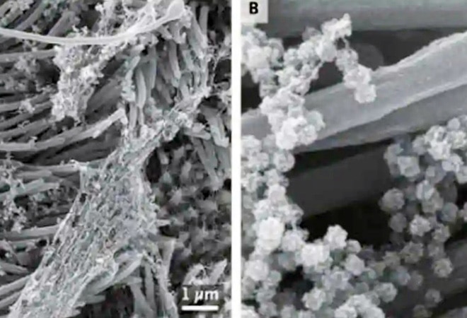 (R) The image shows an infected ciliated cell with strands of mucus attached to the cilia tips. (L) shows the structure and density of SARS-CoV-2 virions produced by human airway epithelial cells. (Photo: New England Journal of Medicine). (R) The image shows an infected ciliated cell with strands of mucus attached to the cilia tips. (L) shows the structure and density of SARS-CoV-2 virions produced by human airway epithelial cells. (Photo: New England Journal of Medicine).