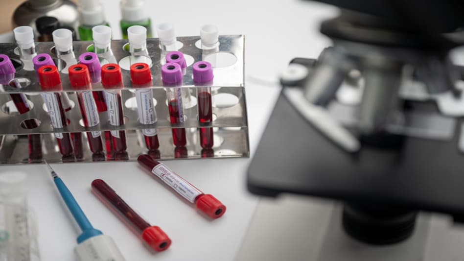 Representative Image Representative Image