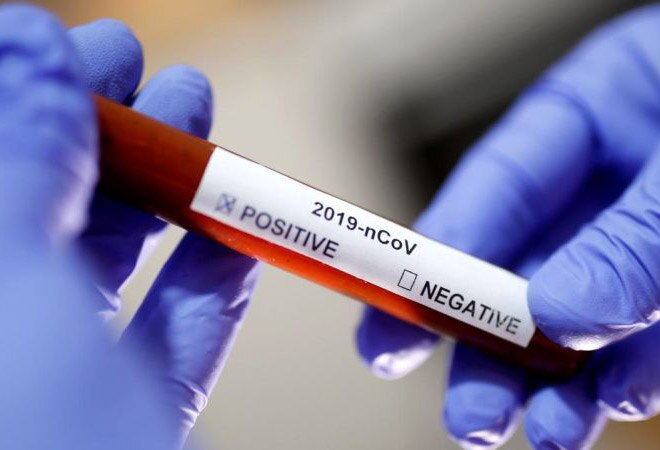 COVID-19: RT-PCR tests in Delhi to cost Rs 800