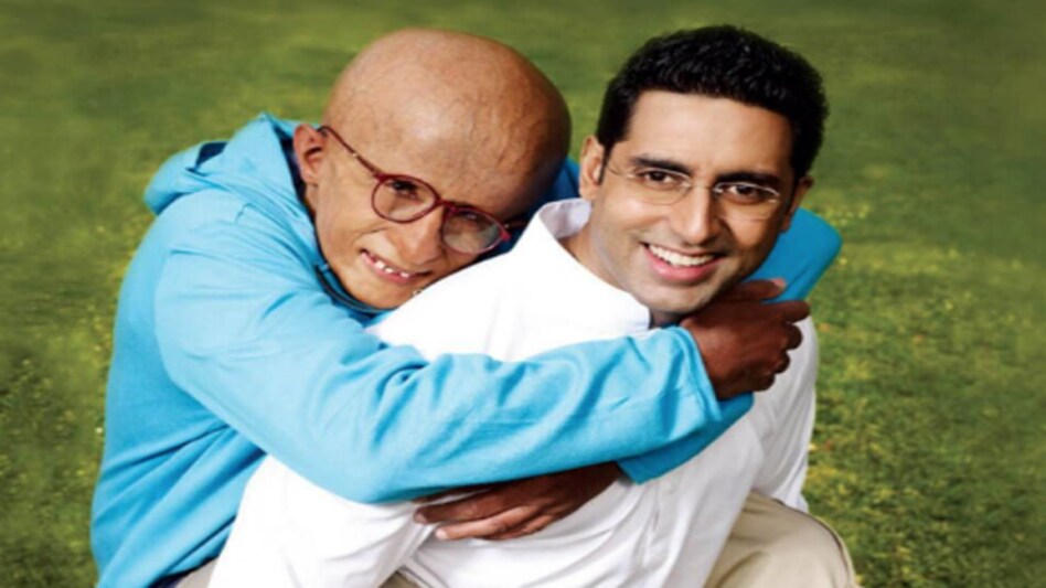 Representative Image Representative Image