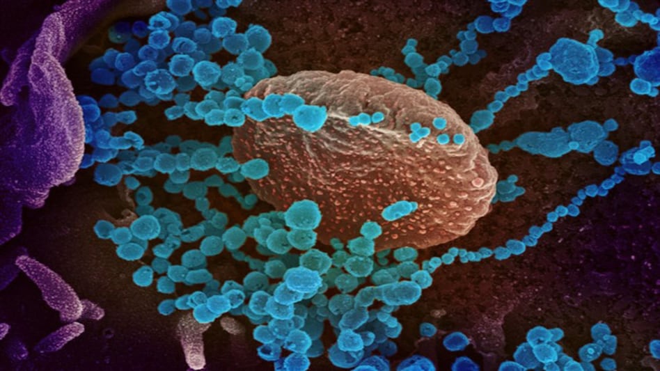 The Chapare virus is believed to be carried by rats, who in turn may have passed it on to humans The Chapare virus is believed to be carried by rats, who in turn may have passed it on to humans