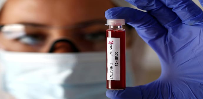At present, India has a 28,000-unit cold storage network that is used for government's universal immunisation programme At present, India has a 28,000-unit cold storage network that is used for government's universal immunisation programme