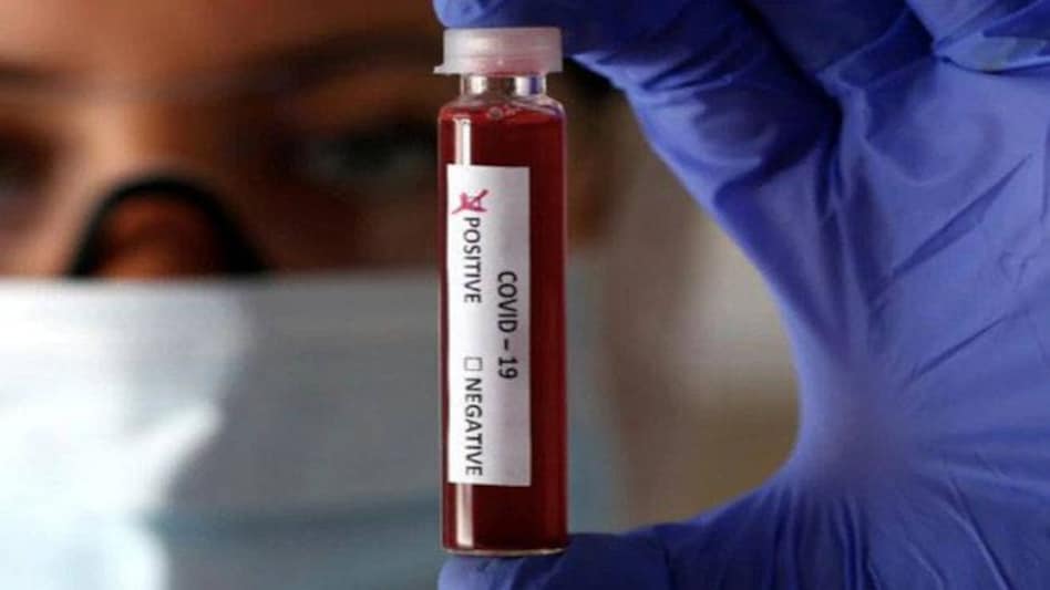 It had launched a mass-testing pilot scheme in the northwest city of Liverpool in November, offering everyone tests whether or not they had symptoms, in an attempt to find a new way to use testing to limit the spread of the coronavirus It had launched a mass-testing pilot scheme in the northwest city of Liverpool in November, offering everyone tests whether or not they had symptoms, in an attempt to find a new way to use testing to limit the spread of the coronavirus