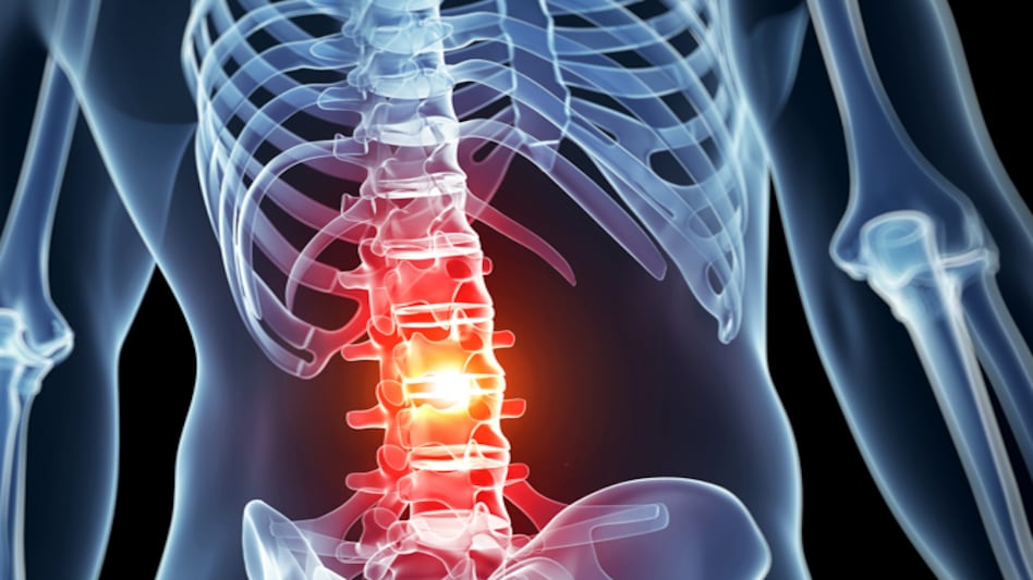 Six elderly patients with spine infection were treated in four weeks at Nanavati Hospital after they recovered from coronavirus Six elderly patients with spine infection were treated in four weeks at Nanavati Hospital after they recovered from coronavirus