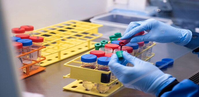 Novavax's protein-based coronavirus vaccine was 89.3 per cent effective in preventing coronavirus in a trial conducted in the UK Novavax's protein-based coronavirus vaccine was 89.3 per cent effective in preventing coronavirus in a trial conducted in the UK