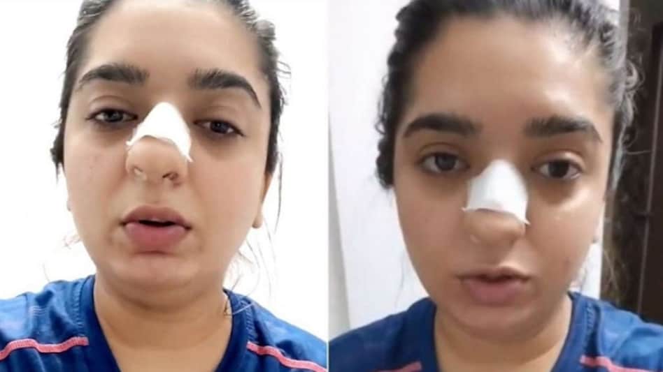 Hitesha Chandranee accused the Zomato delivery man of attacking her over alleged delayed service Hitesha Chandranee accused the Zomato delivery man of attacking her over alleged delayed service