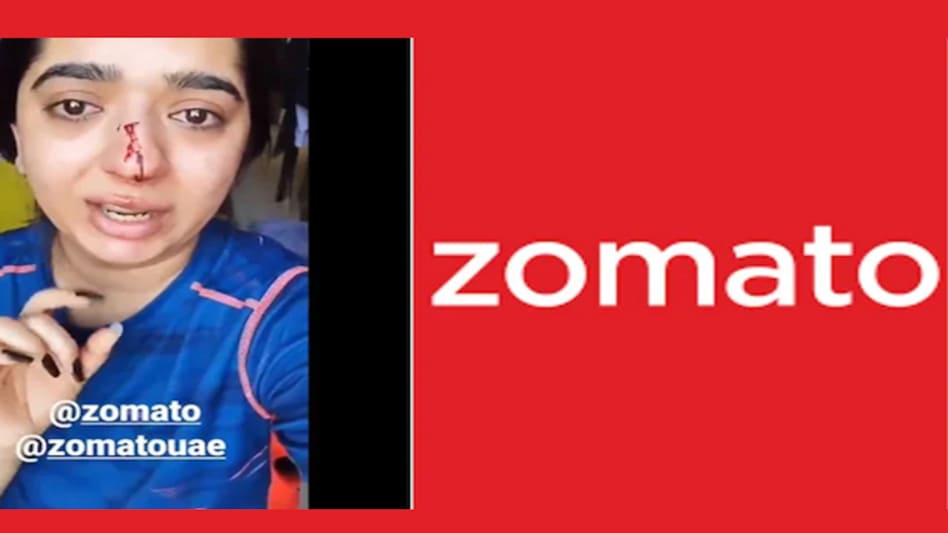 The woman, Hitesha Chandranee, has alleged that the Zomato delivery executive, identified as Kamaraj, "barged" into her home and "attacked her" The woman, Hitesha Chandranee, has alleged that the Zomato delivery executive, identified as Kamaraj, "barged" into her home and "attacked her"