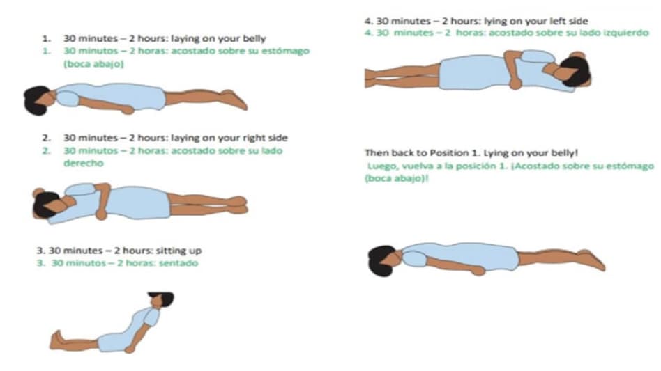 The prone positioning helps to improve ventilation, makes breathing easy. The prone positioning helps to improve ventilation, makes breathing easy.