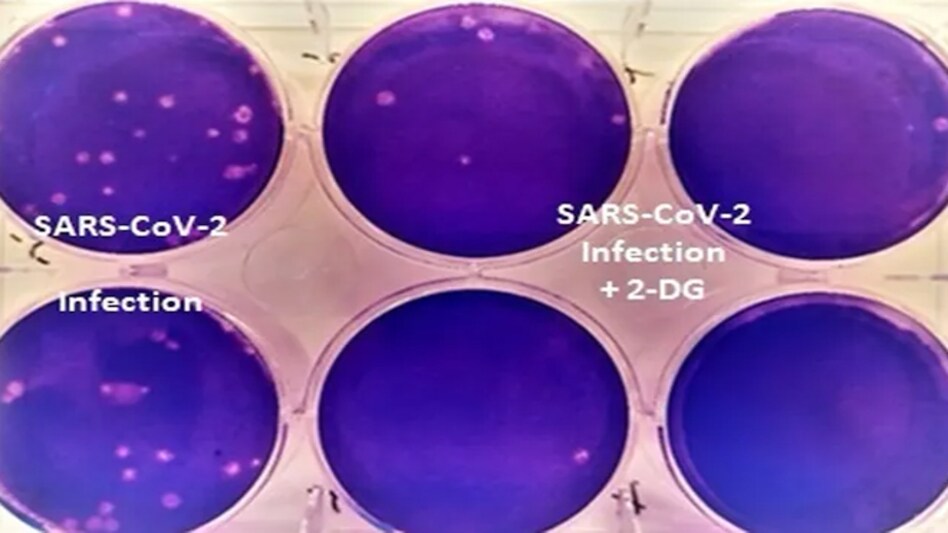 The Drugs Controller General of India (DCGI) has approved teh emergency use of drug 2-deoxy-D-glucose (2-DG) developed by DRDO The Drugs Controller General of India (DCGI) has approved teh emergency use of drug 2-deoxy-D-glucose (2-DG) developed by DRDO