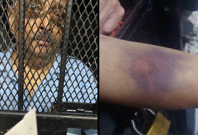 Mehul Choksi was arrested in Dominica on May 26. His lawyers have alleged that he was abducted and beaten up very badly Mehul Choksi was arrested in Dominica on May 26. His lawyers have alleged that he was abducted and beaten up very badly