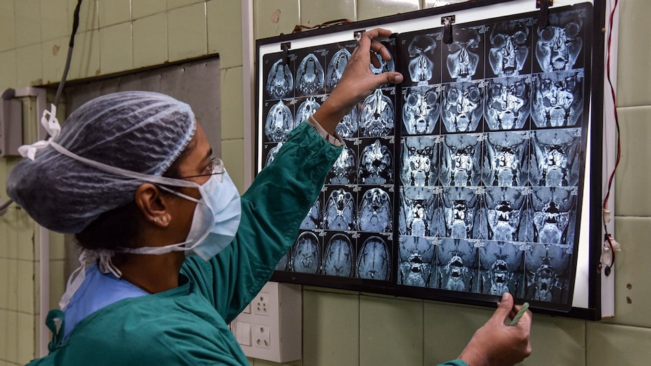 Will COVID-19 plans cover Mucormycosis? Will COVID-19 plans cover Mucormycosis?