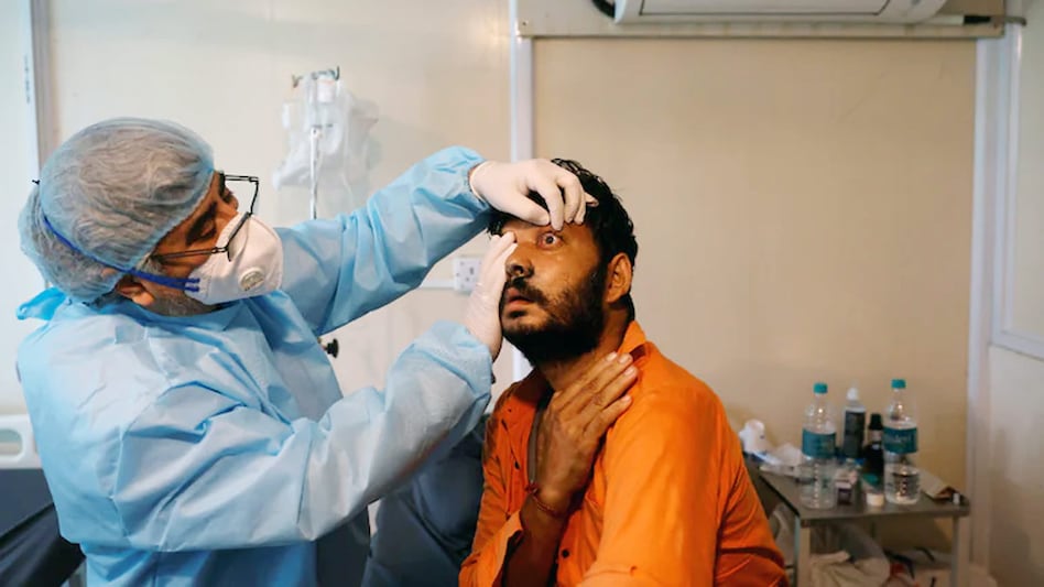 A doctor checks the eyes of a patient who is suffering from mucormycosis also non as black fungus (Reuters photo) A doctor checks the eyes of a patient who is suffering from mucormycosis also non as black fungus (Reuters photo)