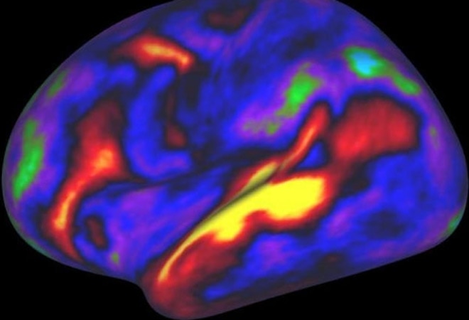 New UK study shows substantial loss of grey matter in brains of recovered COVID-19 patients