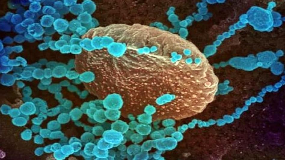 The study has attempted to analyse the role of the DNA segment in establishing COVID-19 outcomes among South Asians The study has attempted to analyse the role of the DNA segment in establishing COVID-19 outcomes among South Asians