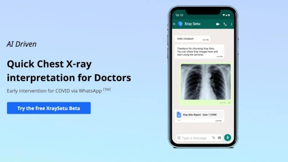 Government launches X-Ray Setu on WhatsApp to detect COVID-19 cases in areas with no RT-PCR tests Government launches X-Ray Setu on WhatsApp to detect COVID-19 cases in areas with no RT-PCR tests