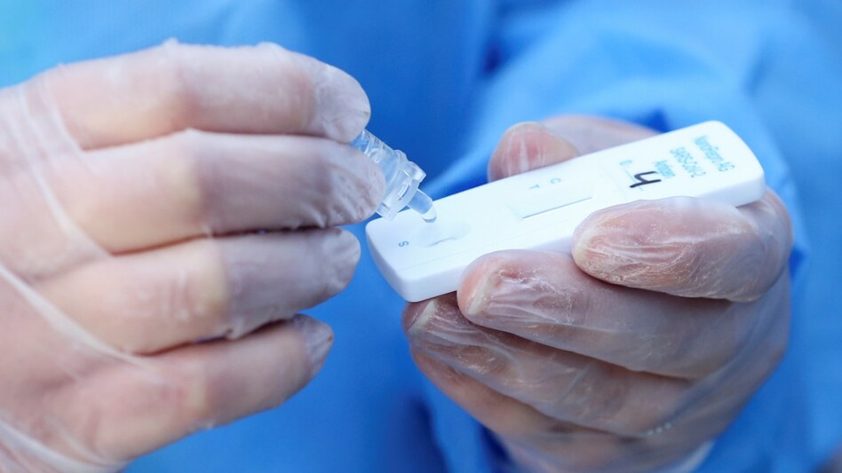 Teenagers in UK are faking Covid-19 positive tests using lemon juice and other hacks from TikTok Teenagers in UK are faking Covid-19 positive tests using lemon juice and other hacks from TikTok