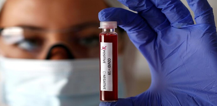 The Institutional Ethics Committee of ICMR-National Institute of Epidemiology, Chennai had approved this study The Institutional Ethics Committee of ICMR-National Institute of Epidemiology, Chennai had approved this study
