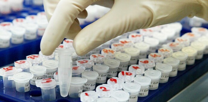 The successful completion of the trial can be a major breakthrough and give scientific validity to India's traditional medicinal system The successful completion of the trial can be a major breakthrough and give scientific validity to India's traditional medicinal system
