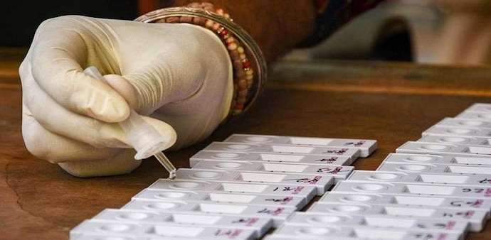 The notification mentions the export of COVID-19 rapid antigen testing kits will now be restricted with immediate effect The notification mentions the export of COVID-19 rapid antigen testing kits will now be restricted with immediate effect