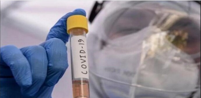 Tech Mahindra along with Reagene Biosciences has filed for the patent for a molecule that can be used to develop a drug against coronavirus Tech Mahindra along with Reagene Biosciences has filed for the patent for a molecule that can be used to develop a drug against coronavirus