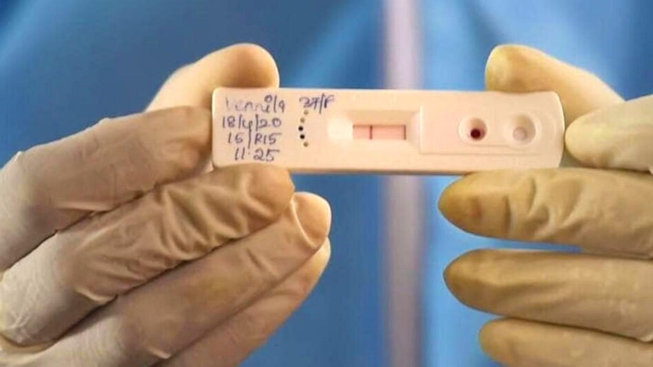 The price of RT-PCR tests has fallen to as little as $7 in some parts of the country, a near tenfold decrease from when they were first made available The price of RT-PCR tests has fallen to as little as $7 in some parts of the country, a near tenfold decrease from when they were first made available