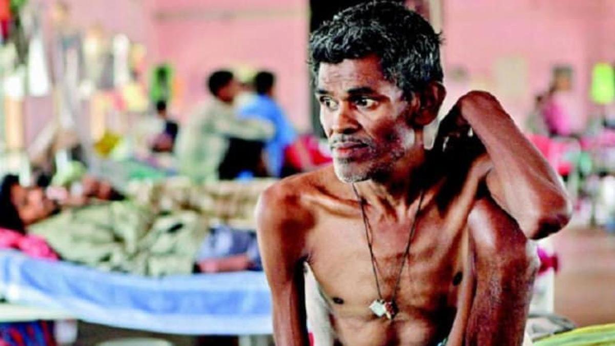 The spurt in diabetes and tobacco smoking, which has impacted TB mortality, needs to be handled. The spurt in diabetes and tobacco smoking, which has impacted TB mortality, needs to be handled.