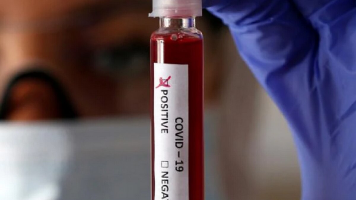 IIT-Kharagpur reports 60 COVID-19 cases, including 40 students, in two days