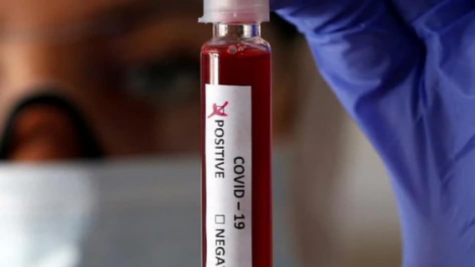 Other than the student-researchers, 20 other infected are from non-teaching staff and faculty Other than the student-researchers, 20 other infected are from non-teaching staff and faculty