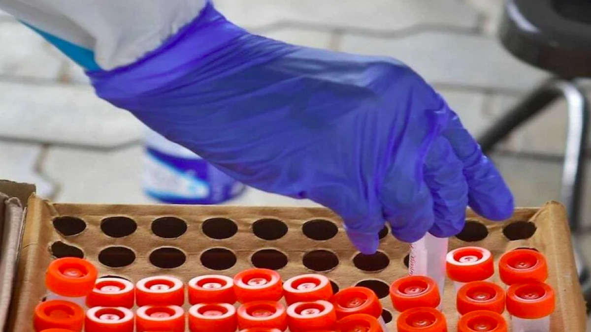 ICMR also stated that testing can be undertaken either through RT-PCR, True Nat, CBNAAT, CRISPR, RT-LAMP, Rapid Molecular Testing Systems or through Rapid Antigen Test (RAT). ICMR also stated that testing can be undertaken either through RT-PCR, True Nat, CBNAAT, CRISPR, RT-LAMP, Rapid Molecular Testing Systems or through Rapid Antigen Test (RAT).