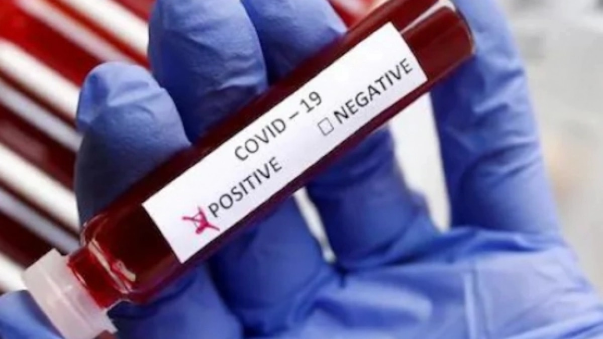 RT-PCR test rates have been very low in most states after price capping and reduced RT-PCR testing will not make a substantial dip in revenues RT-PCR test rates have been very low in most states after price capping and reduced RT-PCR testing will not make a substantial dip in revenues