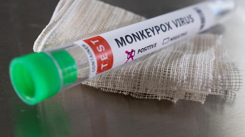 Illustration shows test tube labelled "Monkeypox virus positive. (Photo: Reuters) Illustration shows test tube labelled "Monkeypox virus positive. (Photo: Reuters)