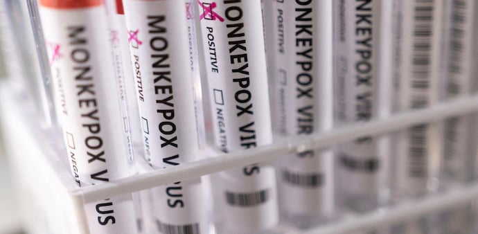 Monkeypox won’t turn into pandemic, but many unknown: WHO (Photo: Reuters) Monkeypox won’t turn into pandemic, but many unknown: WHO (Photo: Reuters)
