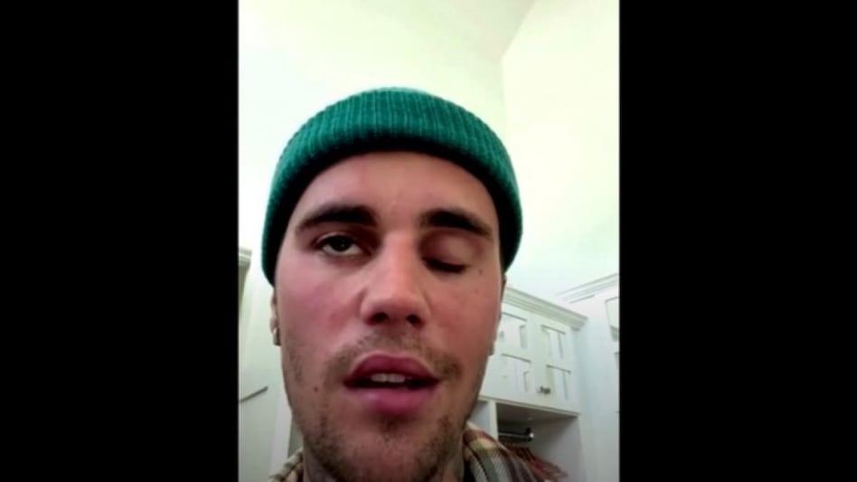 Bieber, 28, said he was physically unable to perform his upcoming shows but was doing facial exercises and expected to recover. Bieber, 28, said he was physically unable to perform his upcoming shows but was doing facial exercises and expected to recover.