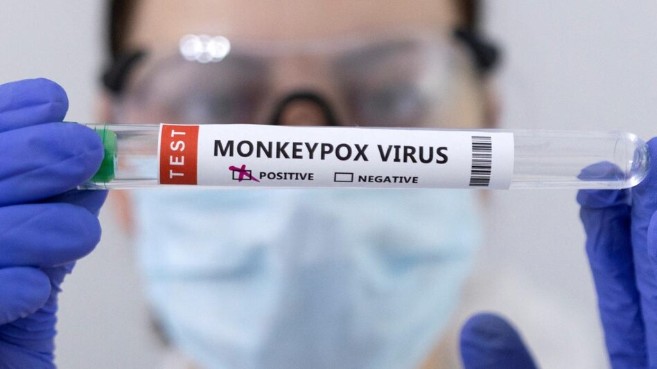 India has reported four cases of monkeypox, including three in Kerala, so far. India has reported four cases of monkeypox, including three in Kerala, so far.