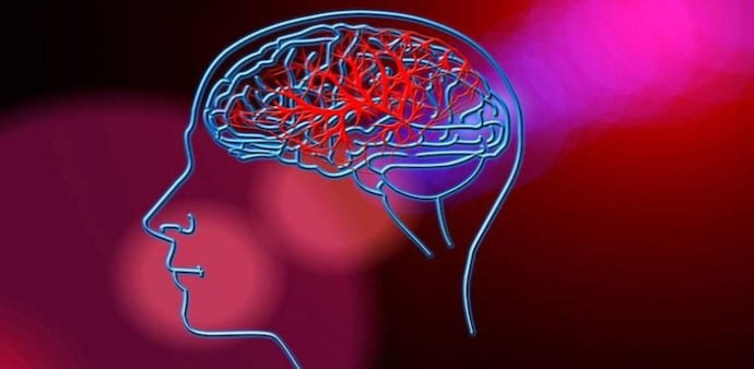 Less than one in four Indians are aware of the symptoms of brain stroke Less than one in four Indians are aware of the symptoms of brain stroke