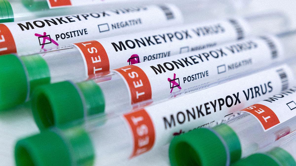 India detects first monkeypox case India detects first monkeypox case