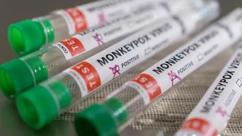 (representative image) (representative image)