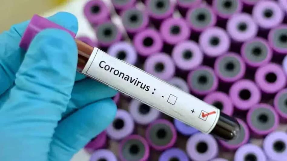 Delhi records 2,073 Covid cases, five deaths in a day; positivity rate 11.64% Delhi records 2,073 Covid cases, five deaths in a day; positivity rate 11.64%
