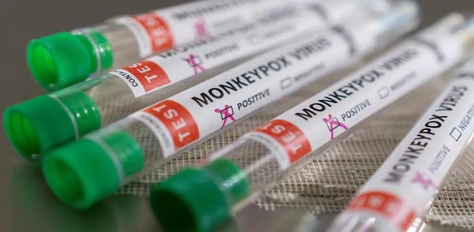 According to WHO, monkeypox is a viral zoonosis or a virus transmitted to humans from animals with symptoms similar to smallpox although less severe. According to WHO, monkeypox is a viral zoonosis or a virus transmitted to humans from animals with symptoms similar to smallpox although less severe.